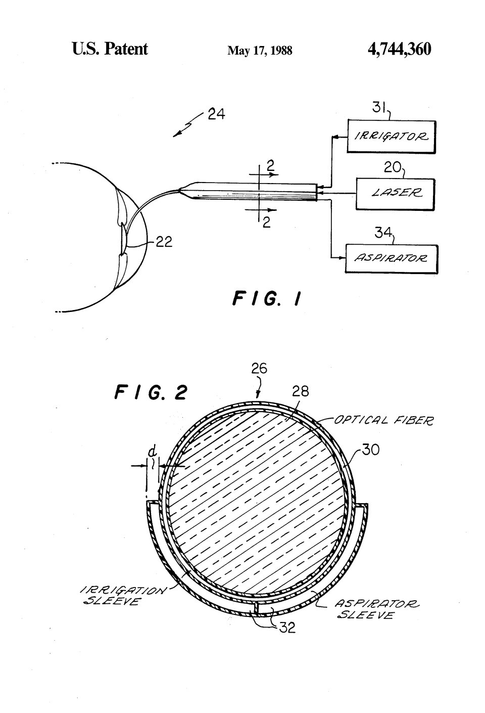 La sonde Laserphaco, Patricia Bath